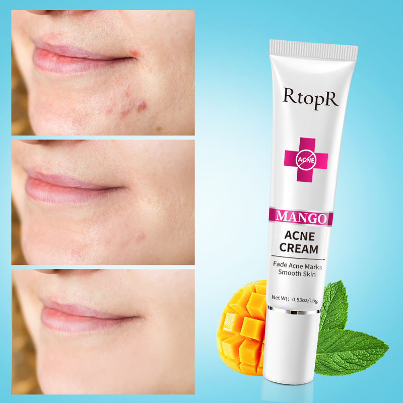  RtopR Kem mụn chiết xuất xoài thu nhỏ lỗ chân lông dưỡng ẩm làm sáng da - INTL 