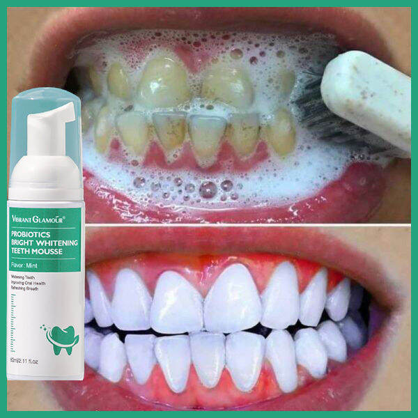 Kem đánh răng Whitening Teeth Mousse Ngừa sâu răng, bảo vệ nướu, làm trắng răng, khử mùi hôi miệng, có thể nuốt với lượng nhỏ, không gây kích ứng。 Làm sạch khoang miệng, ngăn ngừa sâu răng, hơi thở thơm mát