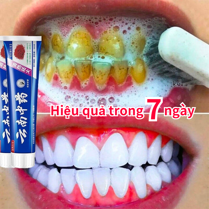 Kem đánh răng làm trắng răng 180g, loại bỏ vàng răng khử mùi hôi miệng mang lại hơi thở thơm mát, giảm sâu răng loại bỏ cao răng và mảng bám trên răng