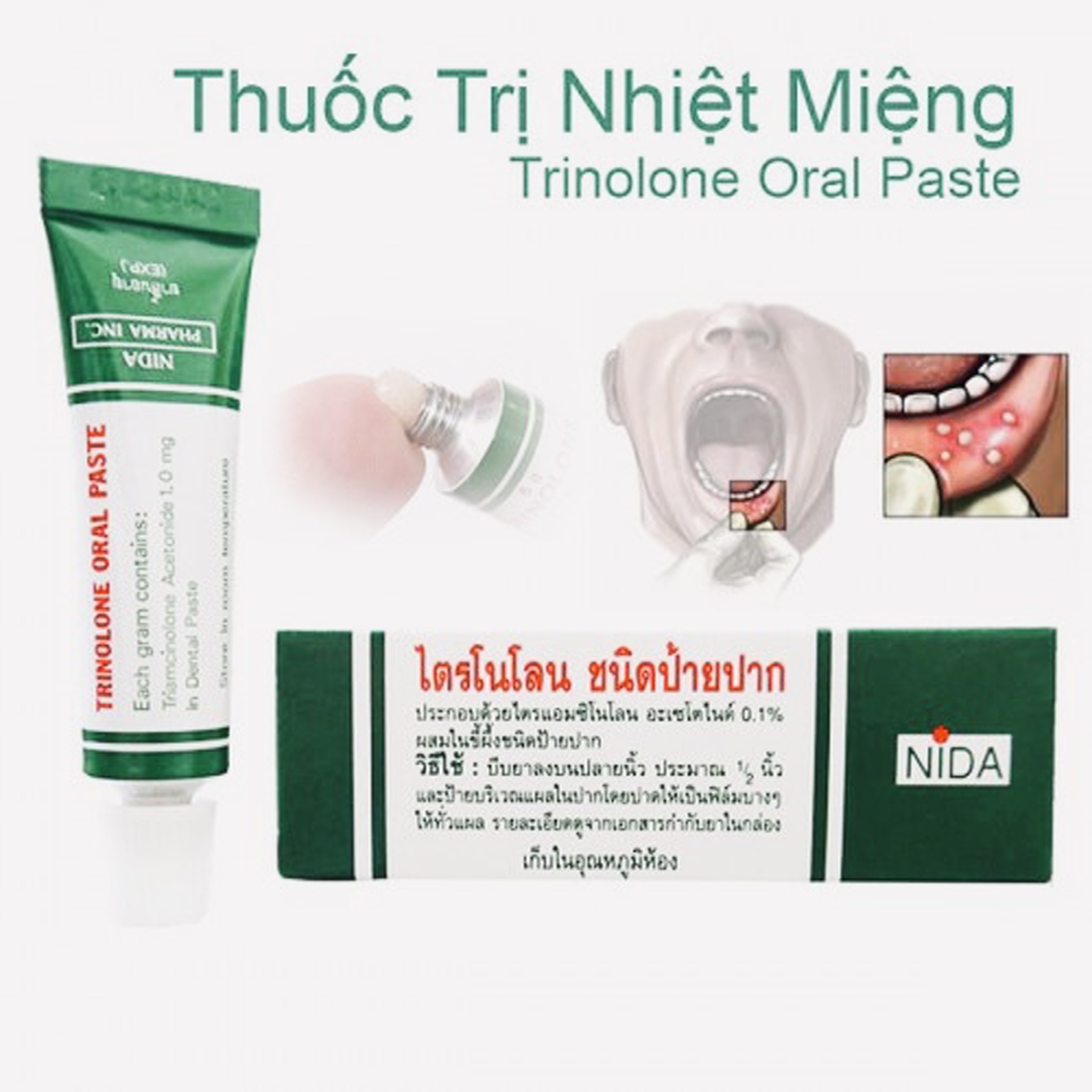 Kem bôi nhiệt miệng Trinolone Oral Paste THÁI LAN