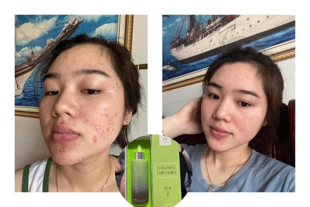 Đông Y Thảo Mộc Linh