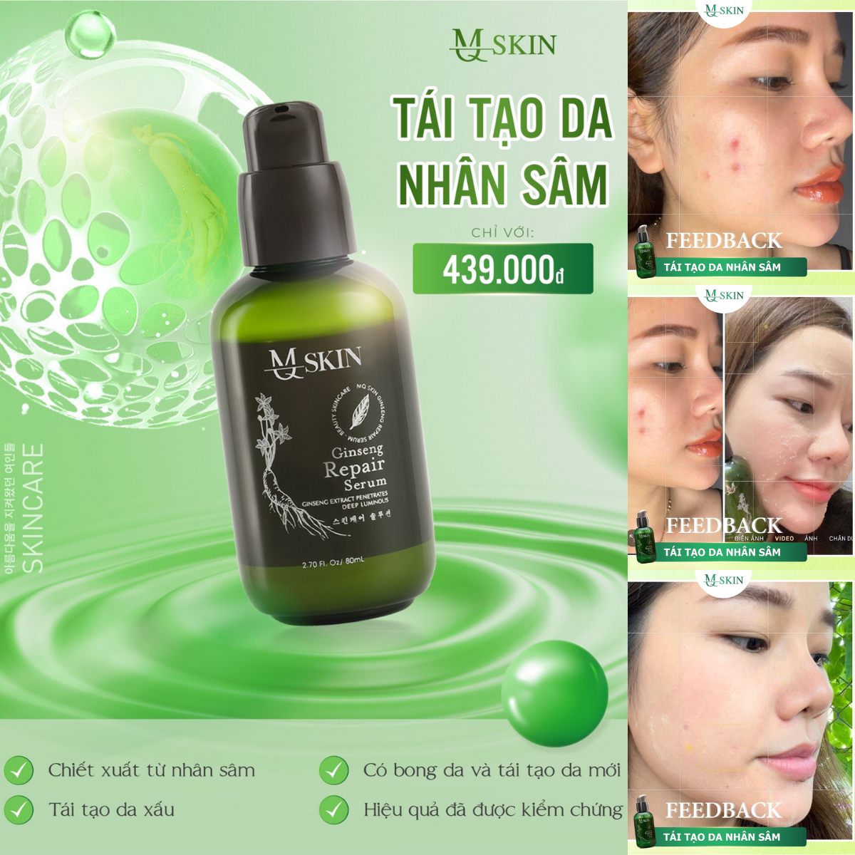  Serum thay da MQ SKIN nhân sâm tái tạo da xóa mụn nám tàn nhang sẹo rỗ 80ml  sâm 1  