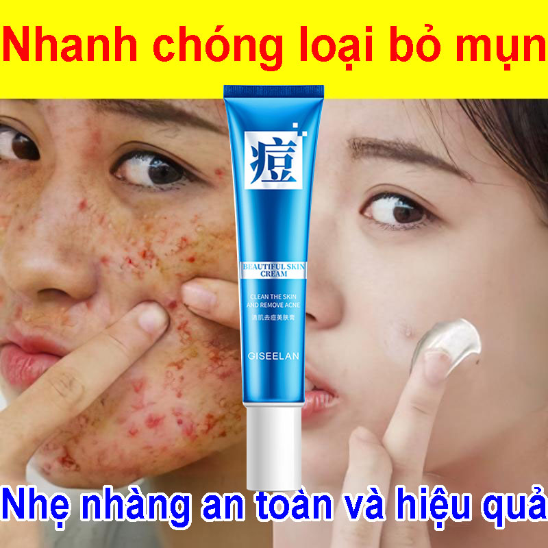 Kem làm trắng da mặt, kem dưỡng ẩm mặt, kem loại bỏ mụn, gel loại bỏ mụn,Làm mờ vết rỗ, loại bỏ mụn trứng cá, thu nhỏ lỗ chân lông, tinh chất thực vật , nam giới và phụ nữ có thể sử dụng