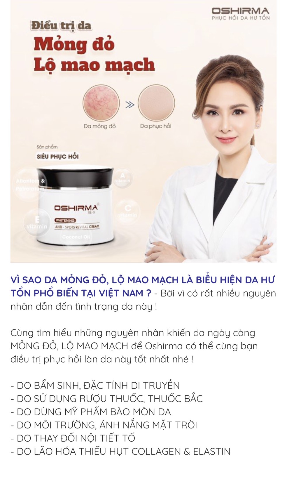 Kem dưỡng ẩm oshima phục hồi da đỏ/ dị ứng/ ngứa cho da nhạy cảm