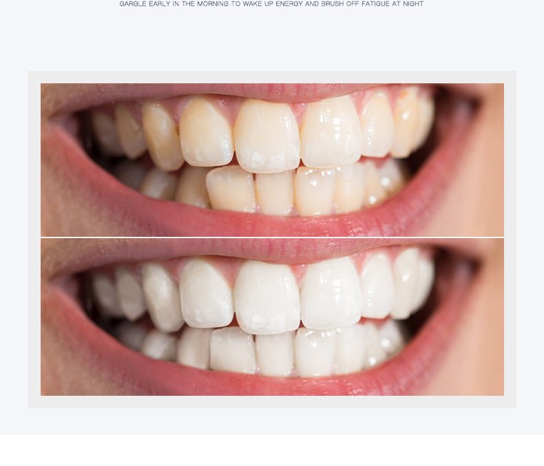 hcmbesdair bọt tẩy trắng răng làm sạch răng khử mùi hôi miệng mousse teeth 3 hcmbesdair bọt tẩy trắng răng làm sạch răng khử mùi hôi miệng mousse teeth 3