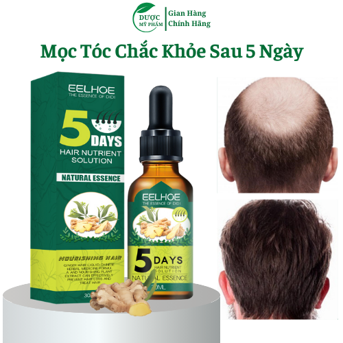 Tinh dầu hết hói, ngăn ngừa tóc gãy rụng, nuôi dương sâu các nang tóc mang lại mái tóc chắc khỏe 30ml
