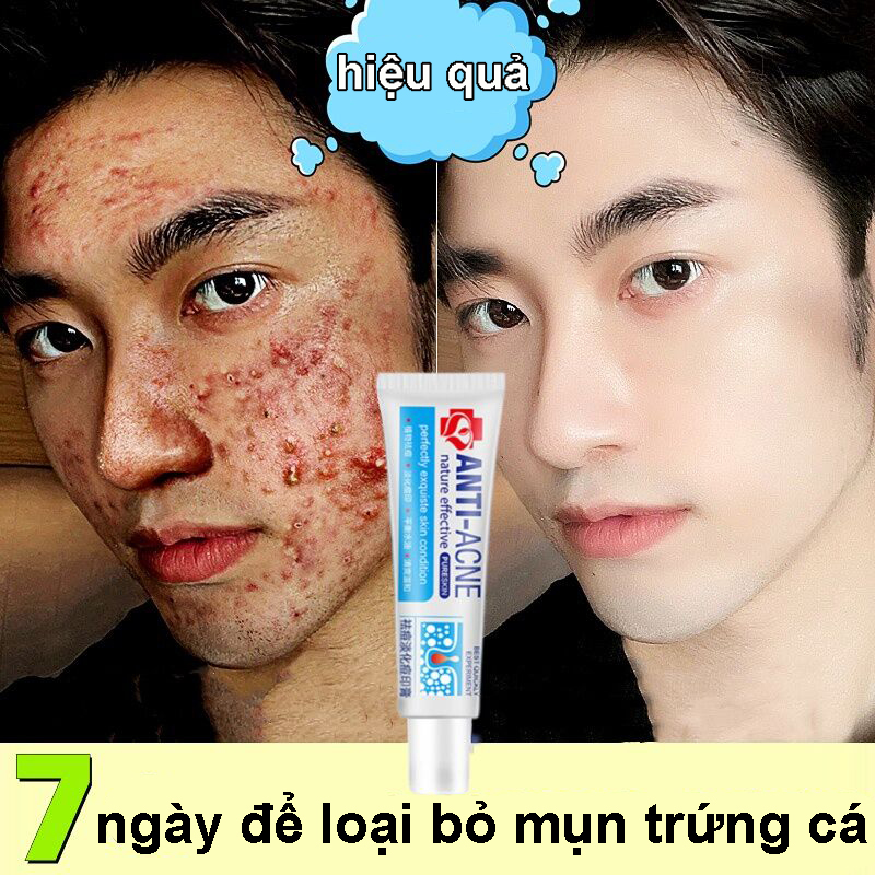  7 ngày xóa mụn kem làm trắng da mặt kem trị mụn gel trị mụn kem dưỡng ẩm da mặt giảm mụn mặt làm trắng và dưỡng ẩm da chiết xuất từ thực vật nhẹ nhàng và không gây kích ứng 