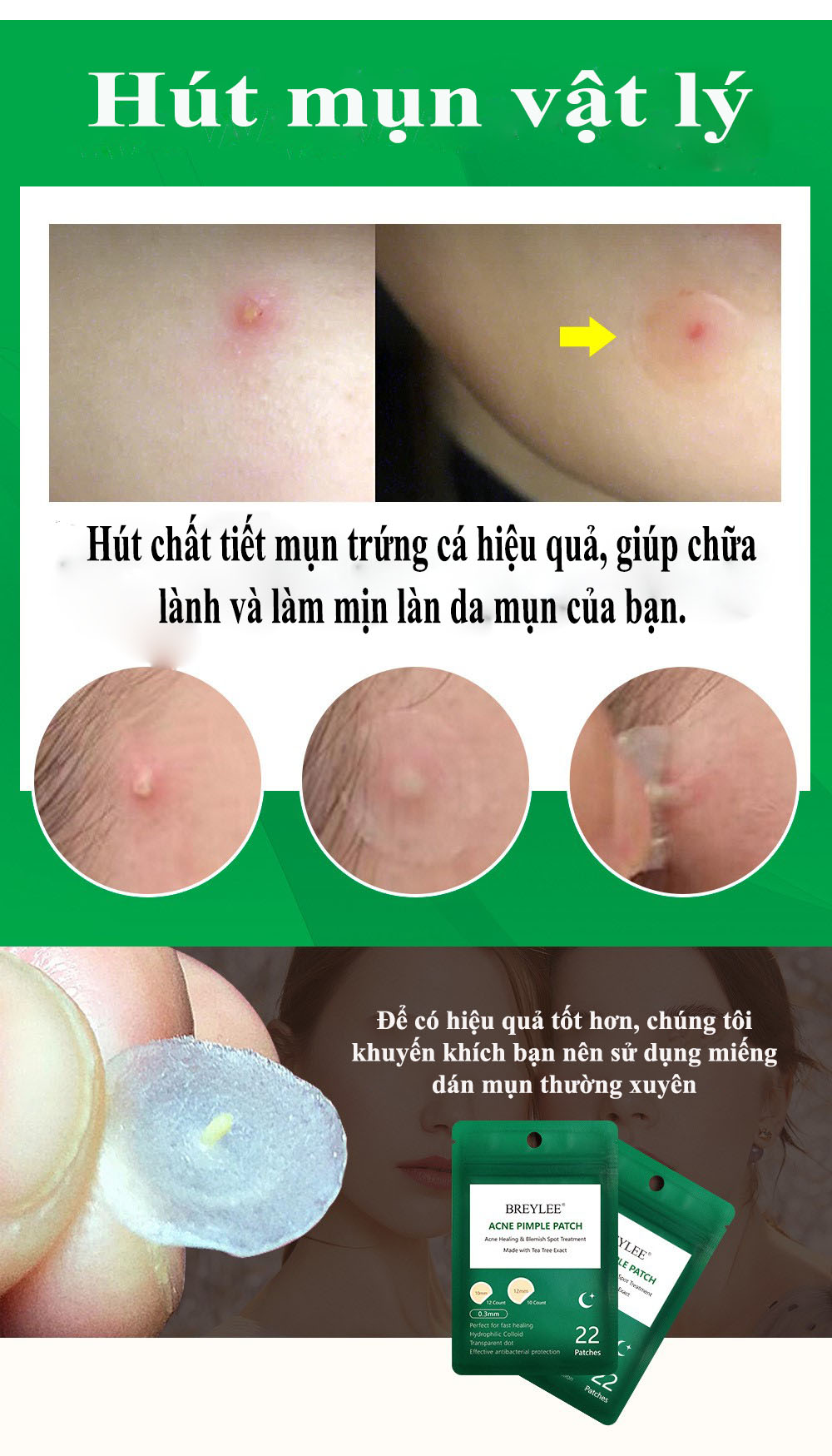 BREYLEE Miếng Dán Tri Mụn Đầu Đen Tri Thâm Mụn Trứng Cá Lột Mụn Đậu Đen Làm Mờ Vết Thâm Do Mụn (Dùng Cho Buổi Tối) FACIAL MASK 22 PATCHES NIGHT USE ACNE PIMPLE PATCH 4