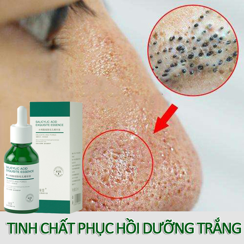 Serum trắng da se lỗ chân lông serum tinh chất làm nhỏ lỗ chân lông 30ml Săn Chắc Mịn Màng Dưỡng Ẩm Sâu Thu Nhỏ Lỗ Chân Lông Cân Bằng Bã Nhờn Làm Sáng Da