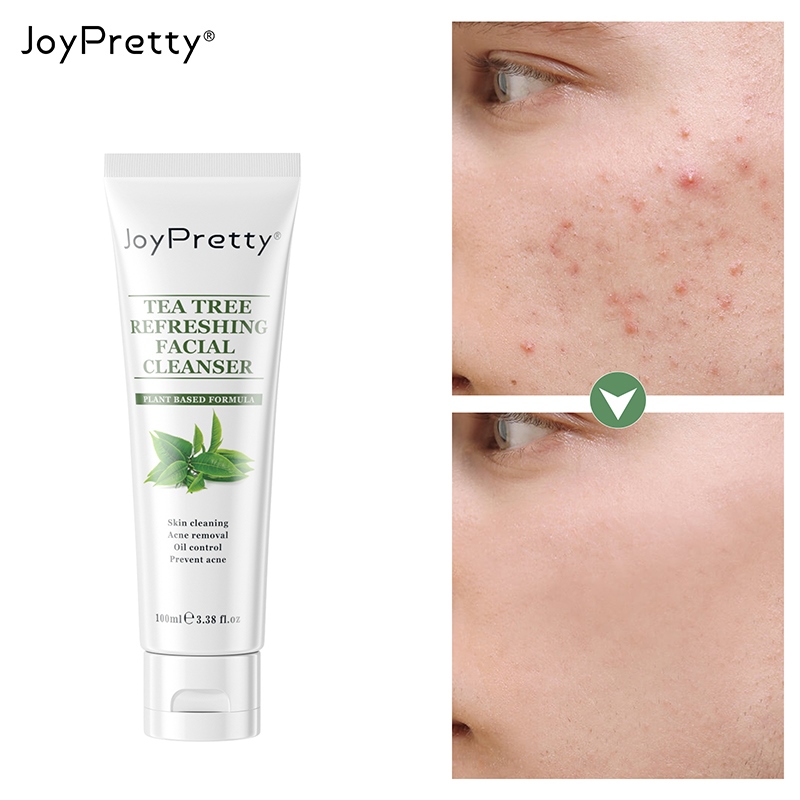 【CW】 100ml Effective Acne Removal Herbal Anti-acne Repair Fade Spots Whitening Moisturizing Cleanser