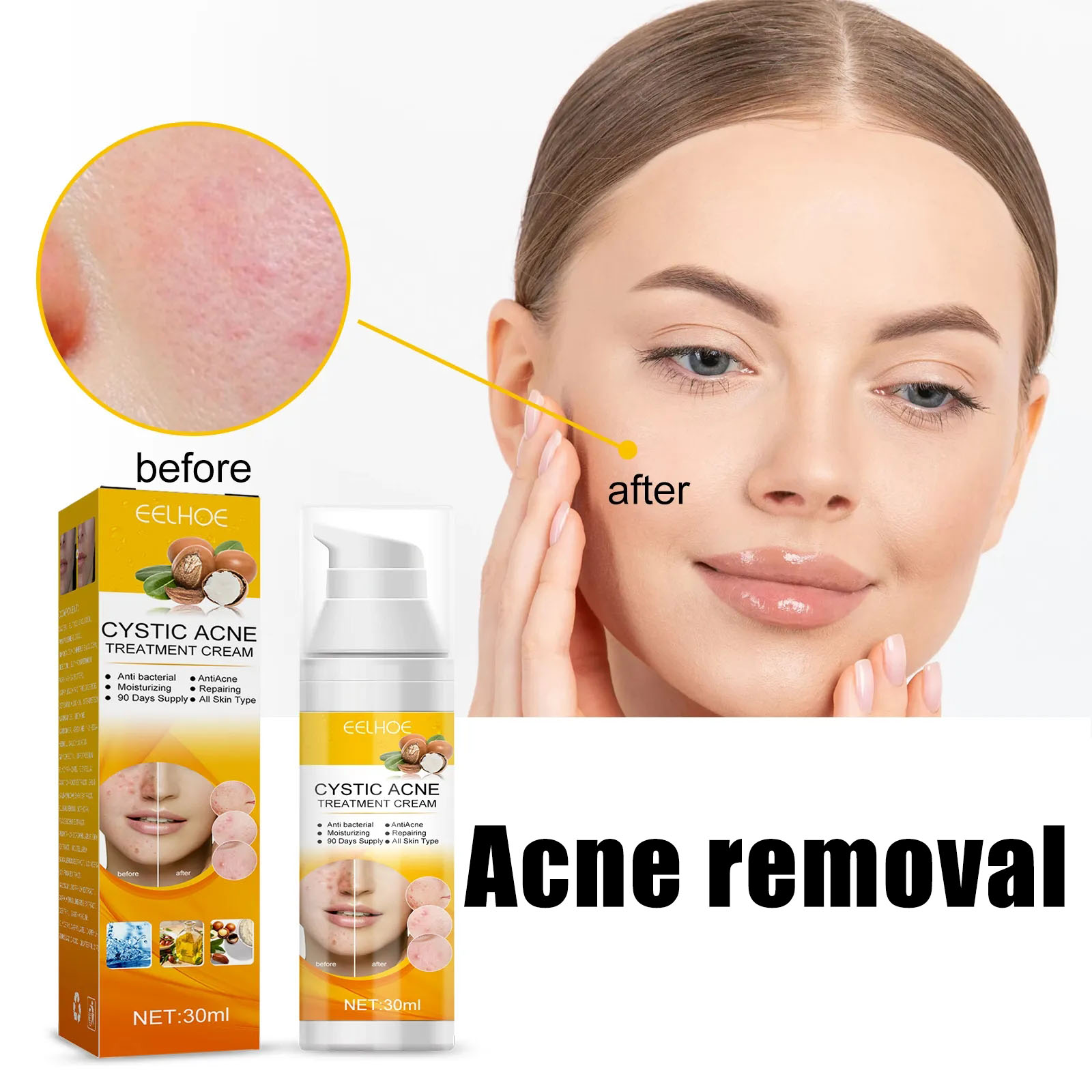 Kem chấm mụn hiệu quả hết mụn siêu tốc ngừa sẹo thâm dành cho da dầu nhờn,Kem giảm mụn chuyên sâu /30ml