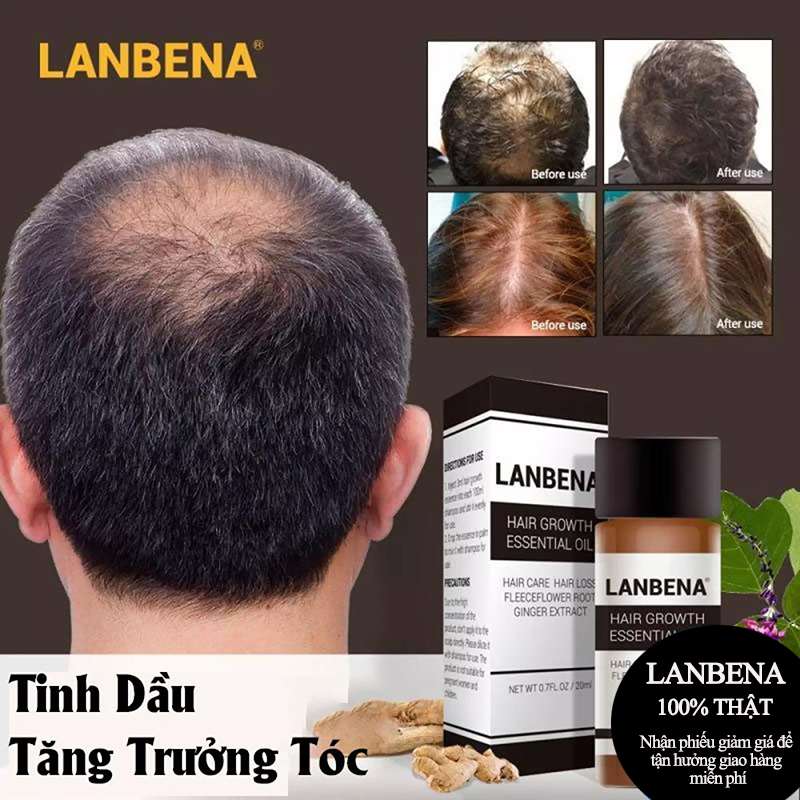 Lanbena 20ML Tinh dầu mọc tóc,Tinh dầu gừng thảo dược dưỡng ẩm chăm sóc tóc,Thúc đẩy sự phát triển của tóc Nuôi dưỡng tóc Ngăn rụng tóc