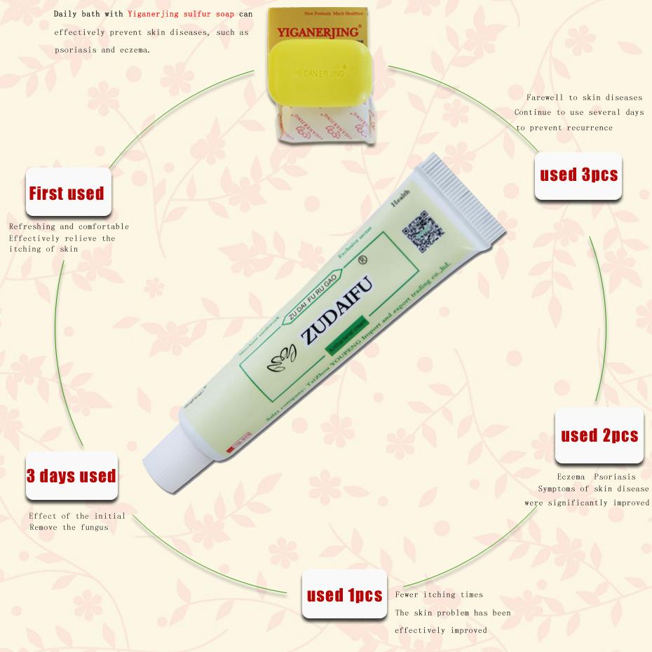 [hcm]zudaifu natural chinese herbal medicine cream eczema dermatitis psoriasis vitiligo antibacterial skin disease treatment 1