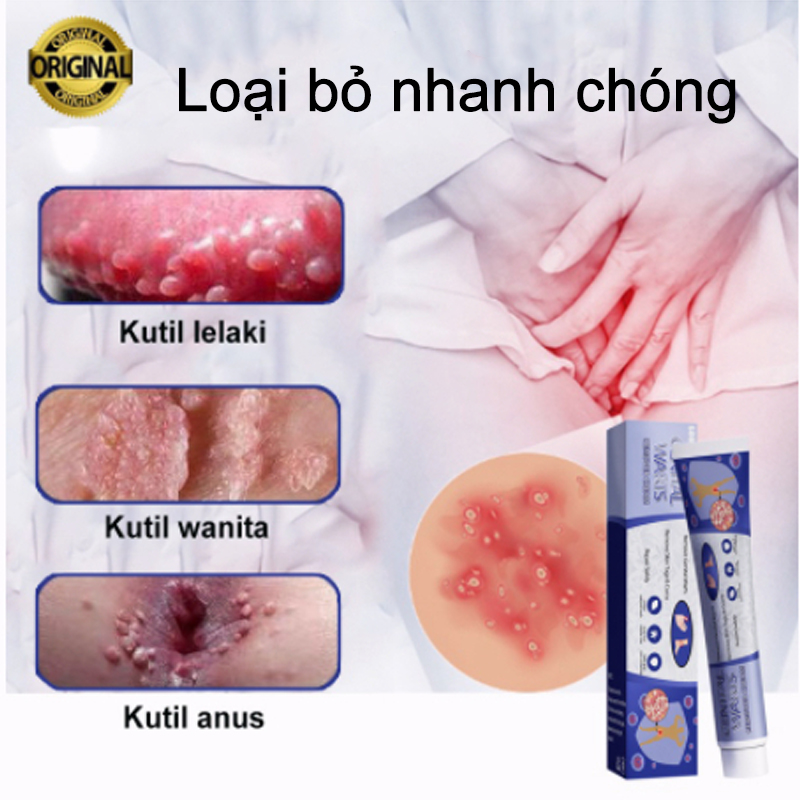 kem bôi rụng hết sạch mụn thịt thừa, mụn cóc, mụn nốt duồi,Kem bôi rụng hết mụn cóc,mụn thịt, mụn cơm, mụn ruồi, nám tàn nhang bay hết nhanh trong vong một nốt nhạc lọ 20g chính hãng, loại bỏ mụn trâu gây khó chịu.