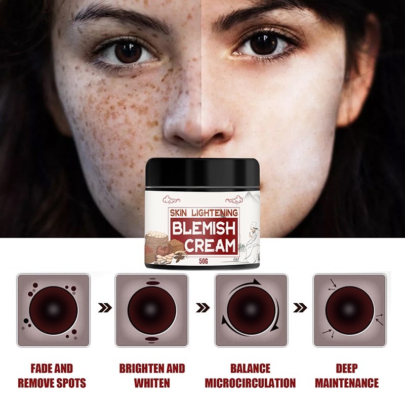 【CW】 2021 Effective Freckle Anti-acne Repair Fade Acne Spots Whitening Moisturizing Face Gel 30/50g