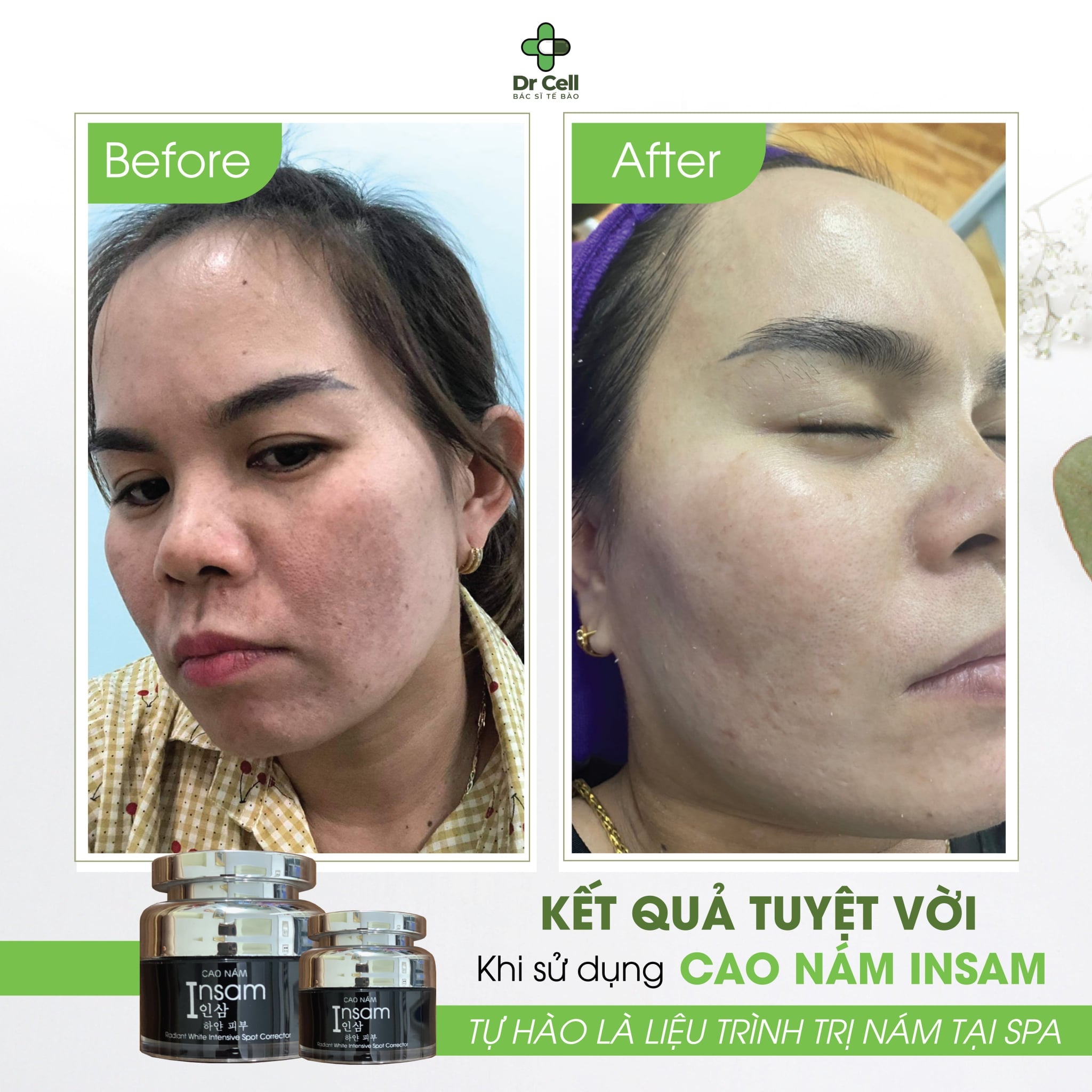 Kem Ngừa Nám Dưỡng Trắng Da Cao Nám Insam DR Cell 20ml dành cho lứa tuổi ngoài 30 có những dấu hiệu thâm nám da hoặc sau sinh giúp mờ nám hiệu quả kết hợp sử dụng trọn bộ để kết quả được tối ưu nhất