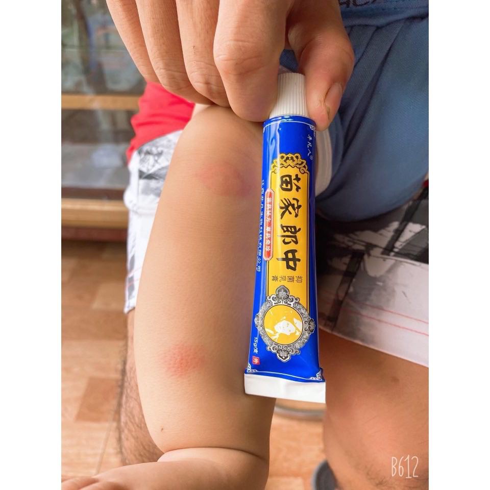 [ kem xanh ] ✅ Kem bôi nấm ngứa, tổ đỉa, hắc lào, lang ben, vảy nến, á sừng, các vấn đề về da - Kie92 Store