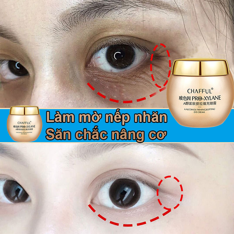 Kem dưỡng mắt chống nhăn  Kem dưỡng mắt với peptide collagen Xóa Nhăn Mắt Và Bọng Mắt  Dưỡng Trắng Vùng Da Quanh Mắt giảm quầng thâm  Làm Mờ Nếp Nhăn Nâng Cơ Săn Chắc Và Đàn Hồi