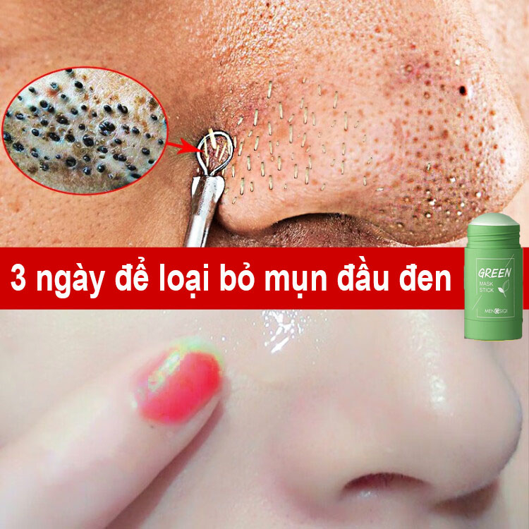 Mặt Nạ Bùn Trà Xanh Dưỡng Ẩm Kiềm Dầu Green Mask Stick Loại Bỏ Mụn Đầu Đen Chăm Sóc Da Mặt Se Khít Lỗ Chân Lông Sáng Da.Mặt Nạ Trà Xanh,Thanh lăn mặt nạ trà xanh Green mask stick - Cam Kết Chính hãng 40