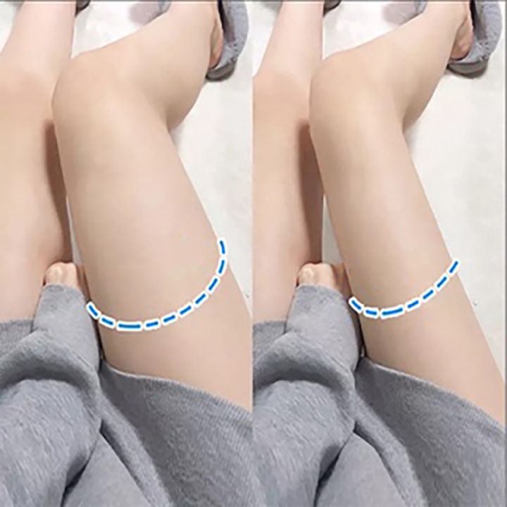 Giảm cân nhanh trong）Miếng dán thần kỳ tan mỡ bụng miếng dán giảm béo miếng dán giảm béo an toàn cân nhanh chóng đốt cháy mỡ thừa giao hàng siêu tốc