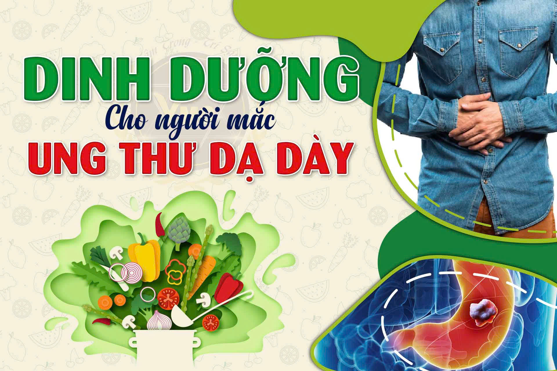 Dinh dưỡng cho người mắc ung thư dạ dày Giá 800,000 Đồng*Miễn phí vận chuyển
