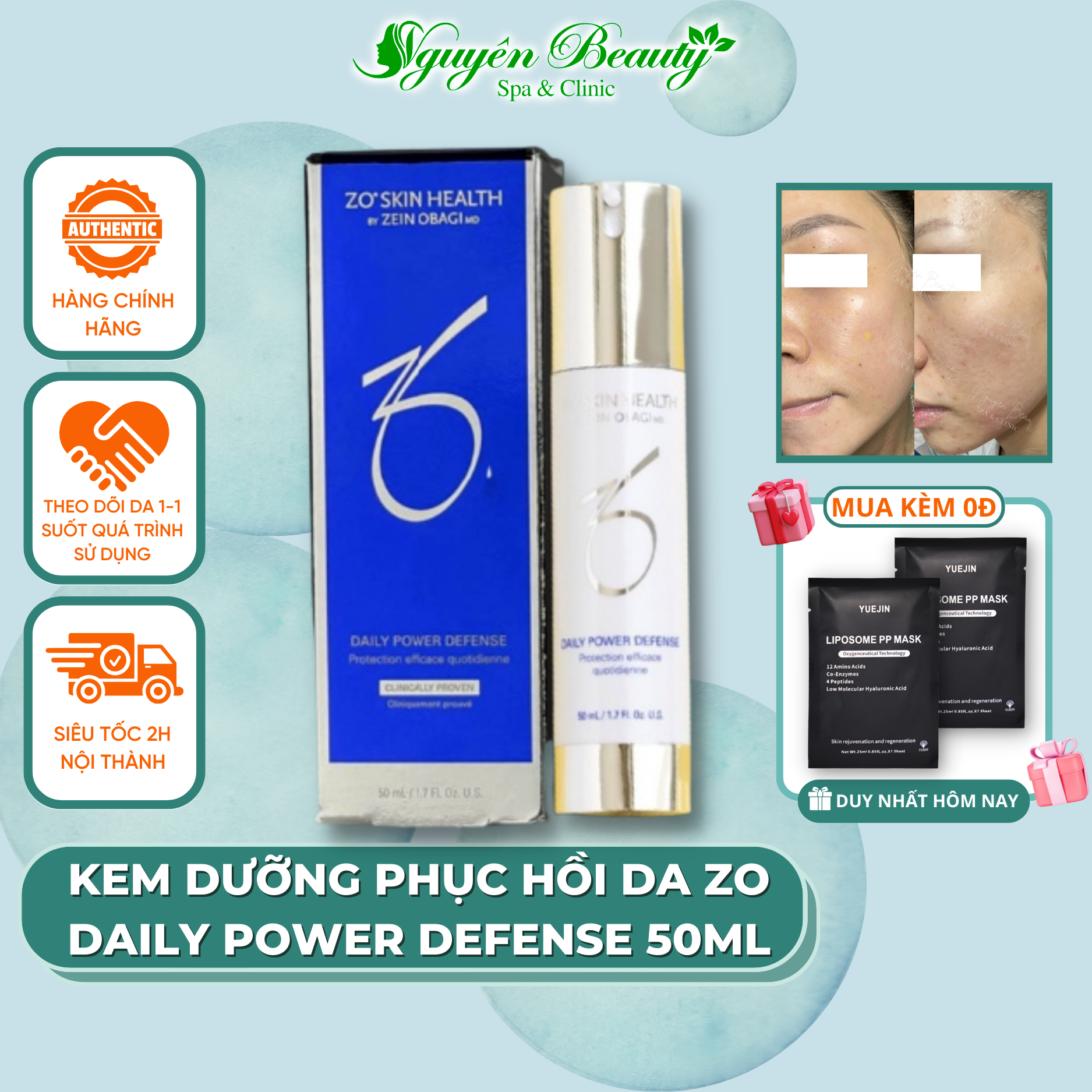 Kem dưỡng phục hồi da zo skin health daily power defense giúp săn chắc, căng mịn da, mờ nếp nhăn 30ml, 50ml