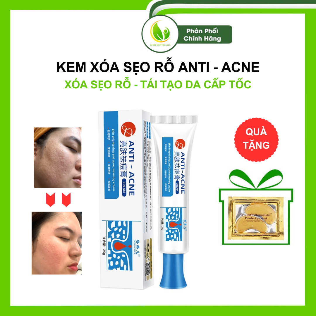 Kem xóa sẹo rỗ Anti - ACNE - Giups xóa sẹo rỗ lâu năm, sẹo rỗ mụn tái tạo da cấp ẩm không tái đi tái lại
