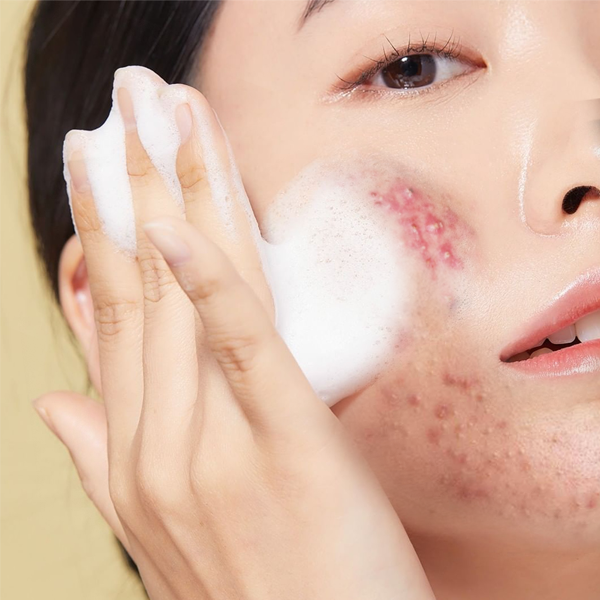 Sửa rửa mặt trắng da trị mụn sữa rửa mặt trị mụn cho da dầu máy xông hơi mặt sữa rửa mặt làm trắng da sữa rửa mặt màu hồng sữa rửa mặt đông y rửa mặt axit sữa rửa mặt thảo dược sữa rửa mặt axit amin sữa rửa mặt tầng sâu