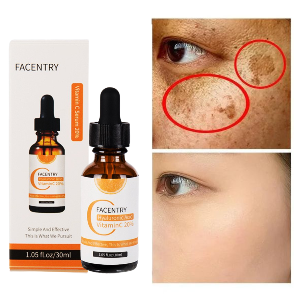 Serum Vitamin C xóa nhăn vĩnh viễn Giúp Da Trắng Sáng Mịn, Đều Màu, Hết Sạch Thâm, Ngăn Ngừa Lão Hoá Chỉ Trong Vài Ngày.