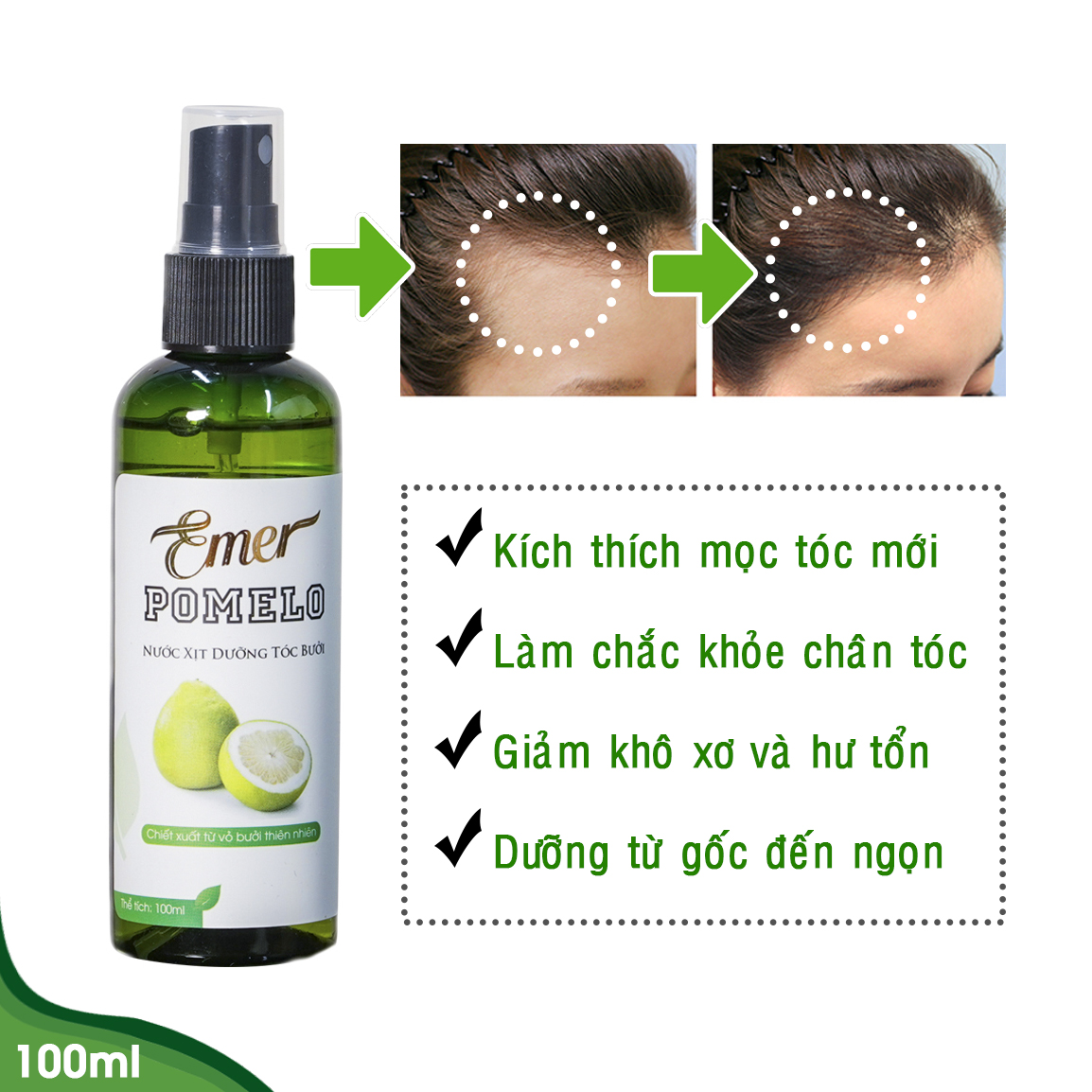 [HCM]Nước Xịt Dưỡng Tóc Chai Xịt Tinh Dầu POMELO Dưỡng Tóc Kích Thích Mọc Tóc 100ml