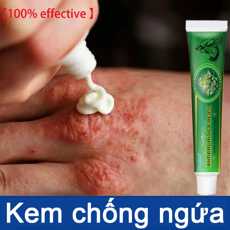 Kem loại bỏ vẩy nến nấm da hắc lào á sừng viêm da ngứa tay chân da đầu mông nấm Giảm ngứa 20g