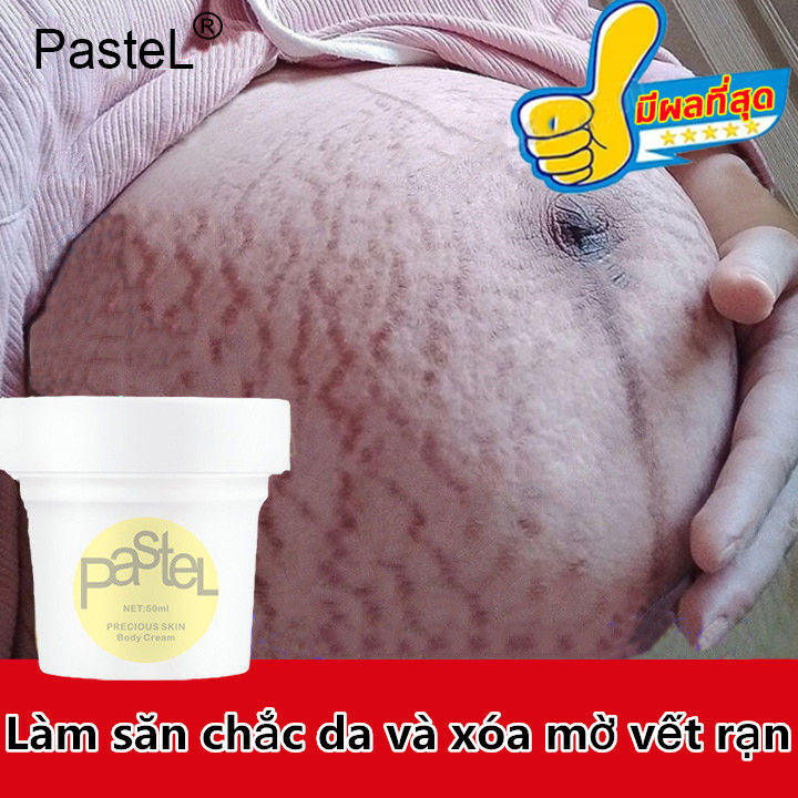 Kem xóa rạn da, ngăn ngừa rạn da khi mang thai, làm mờ vết rạn da sau sinh, xóa vết rạn da do tăng cân, làm mờ vết thâm, làm mịn da, cải thiện sẹo lâu năm