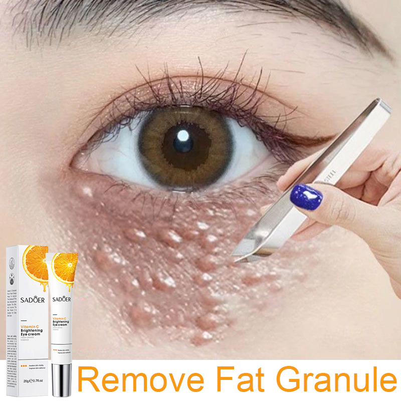 Kem dưỡng mắt sadoer vitamin c chống quầng thâm chống túi mắt chống nhăn giảm thâm quầng mắt, nếp nhăn, bọng mắt