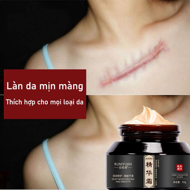 Scar Cream Kem loại bỏ sẹo kem chăm sóc sẹo Làm mờ vết sẹo Xóa bỏ rạn da, bỏng nước, bỏng lửa, sẹo phẫu thuật, phục hồi làn da mịn màng