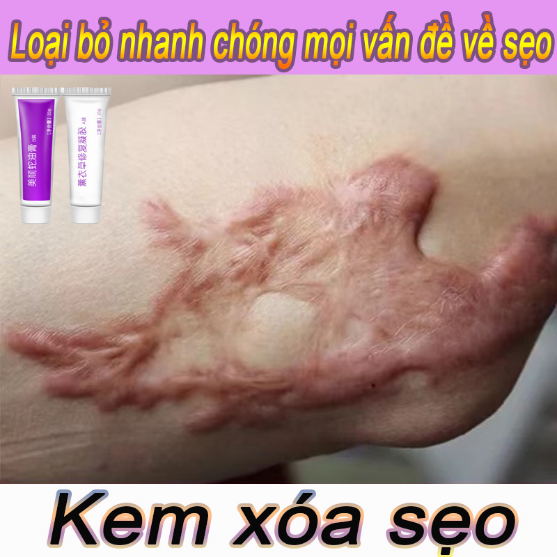 Kem làm mờ sẹo Kem xóa sẹo Kem chuyên xóa sẹo lồi lâu năm 2 trong 1 phục sẹo bỏng, sẹo mụn trầy xước, làm mờ sẹo thâm, khôi phục da, làm mờ vết sẹo, nuôi dưỡng tái tạo làn da