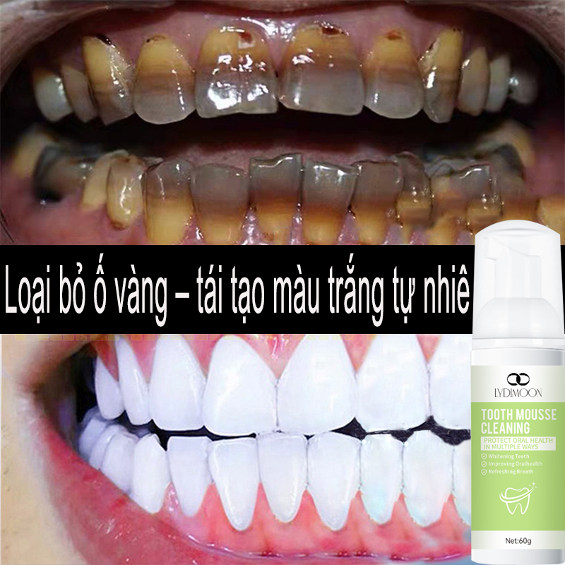 Kem đánh răng kem đánh răng trắng răng trắng răng mousse đánh răng LYDIMOON 60g Tươi mới không cay miệng