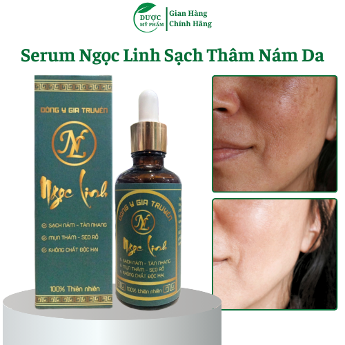 Tinh chất tái tạo da đa tầng hết mụn nám tàn nhang làm đầy sẹo rỗ và se khít lỗ chân lông 50ml như kem hàn quốc nhạt bản MUA 2 LỌ TẶNG 1 LỌ TINH CHẤT VÀNG 24K