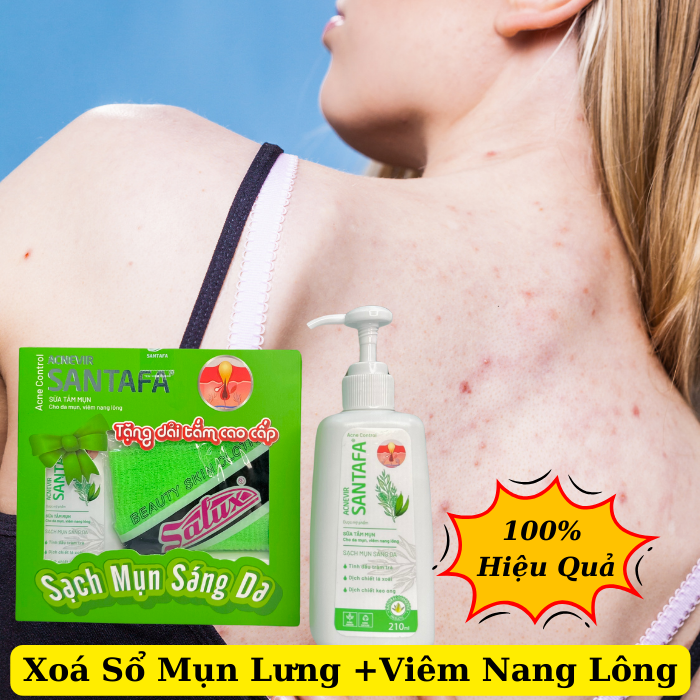 Sữa tắm giảm mụn lưng chuyên biệt dành cho da mụn hỗ trợ thu nhỏ lỗ chân lông, viêm nang lông acnevir santafa chai 210ml