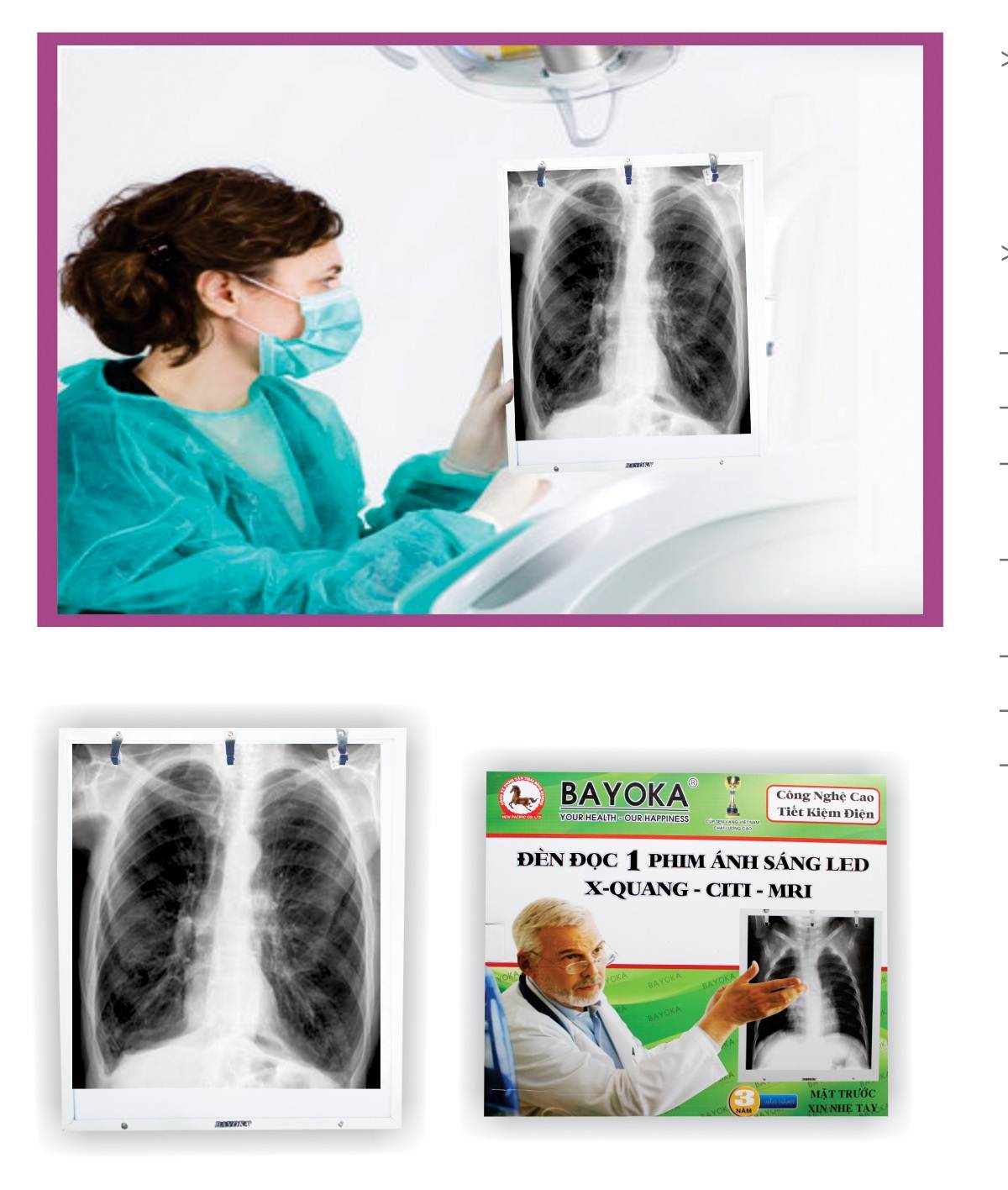Đèn đọc 1 phim x-quang ct mri ánh sáng led bayoka