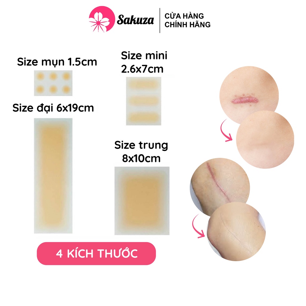 Miếng dán che khuyết điểm che sẹo lồi sẹo lõm sẹo thâm tiệp màu da Sakuza 4 kích thước A1001
