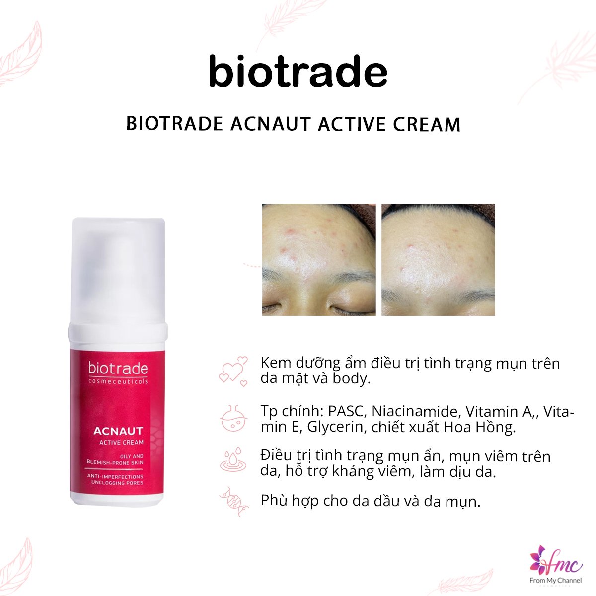 Kem Dưỡng Ngừa Mụn Biotrade Acnaut Active Cream 30ML