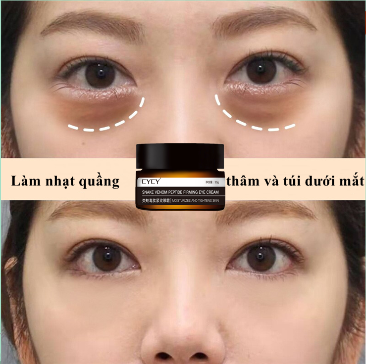 Kem dưỡng mắt mờ thâm nhăn Night Repair Eye 30g chống nhăn và săn chắc vùng mắt Loại bỏ quầng thâm mắt kem chống nhăn Dưỡng ẩm loại bỏ bọng mắt