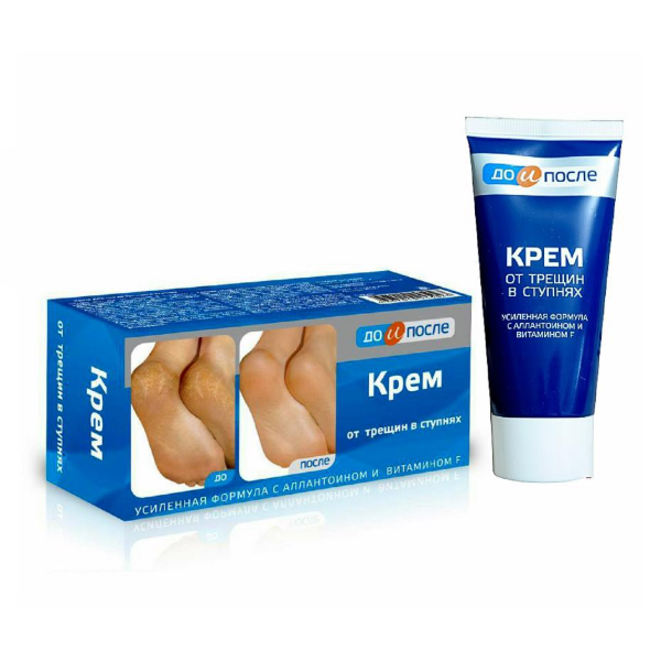 Kem Hỗ Trợ Cải Thiện Nứt Gót Chân Kpem Apteka Của Nga 50ml
