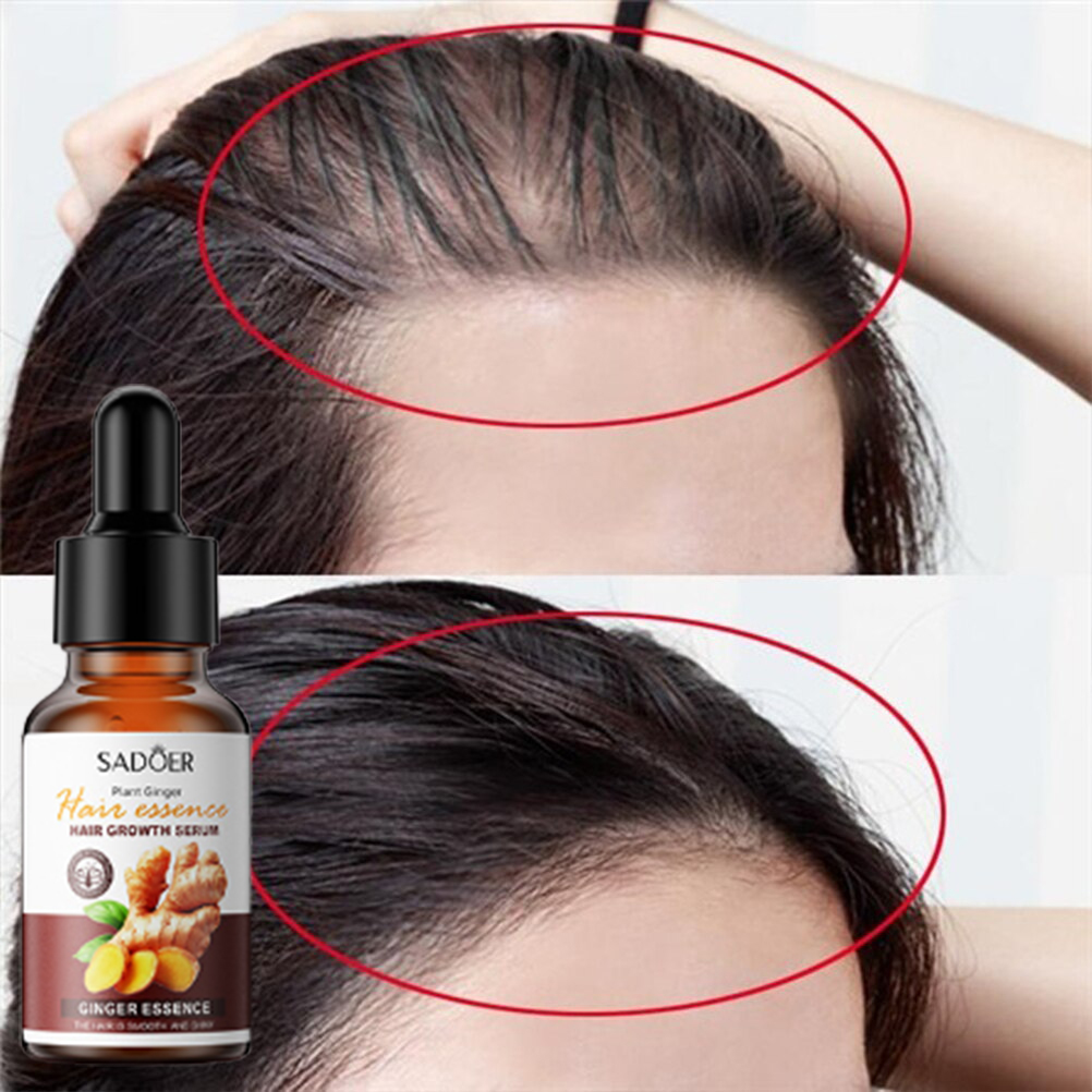 Thuốc mọc tóc serum kích mọc tóc chống rụng tóc kích mọc tóc chăm sóc tóc 30ml kích thích mọc tóc nhanh làm dày