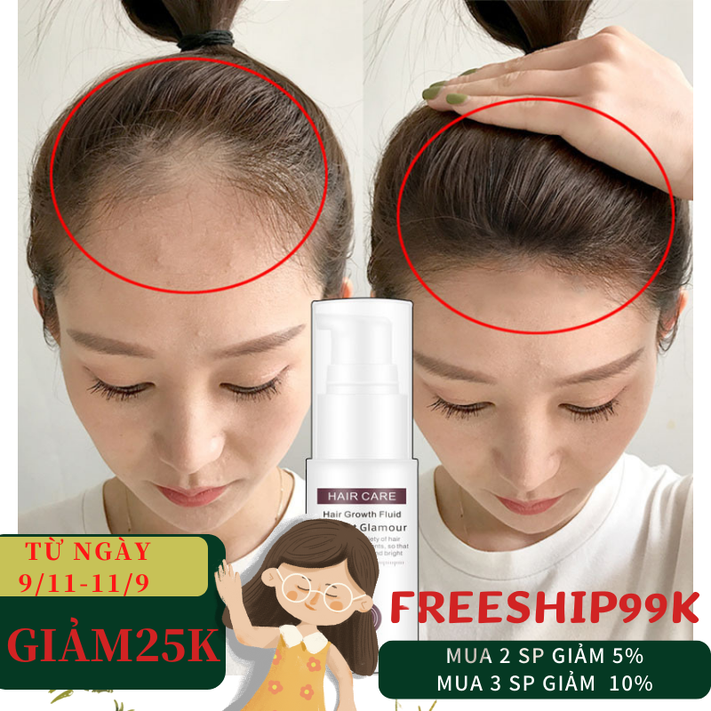 [HCM]Tinh dầu kích mọc tóc nhanh ngăn ngừa rụng tóc chai tinh dầutinh chất giúp tóc mọc nhanh chống rụng tóc Tinh chất tăng trưởng tóc nhanh Hair Grower Dầu xả tóc Tinh chất ngăn ngừa rụng tóc cho nam và nữ 30ML