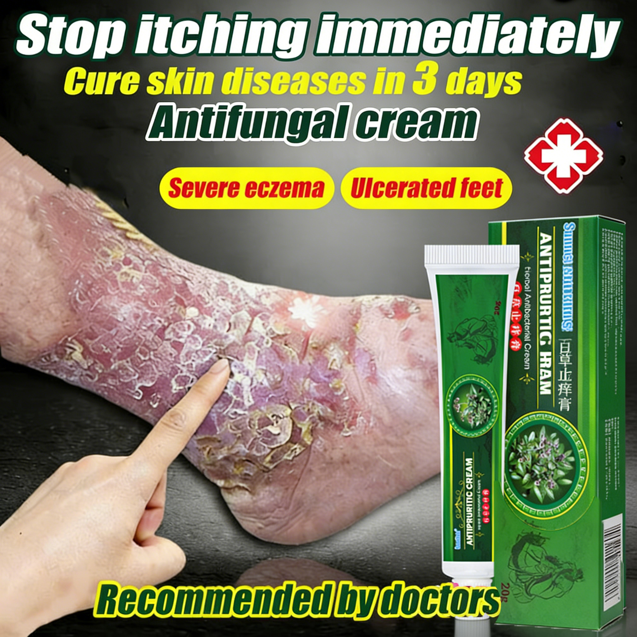 [Giảm ngứa tức thì trong 30 giây] Kem chống nấm, kem trị chàm, kem trị vảy nến  Dứt Điểm Viêm Da Cơ Địa Nấm Ngứa, Hắc Lào, Tổ Đỉa, Ghẻ Nước Cực Kì Hiệu Quả