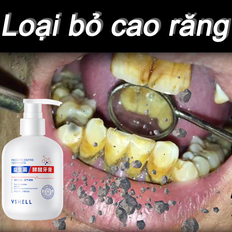 Kem đánh răng tẩy ố vàng tẩy trắng răng loại bỏ cao răng hôi miệng 250g làm trắng răng phục hồi nướu hư tổn sâu răng tẩy trắng răng ố vàng lâu năm