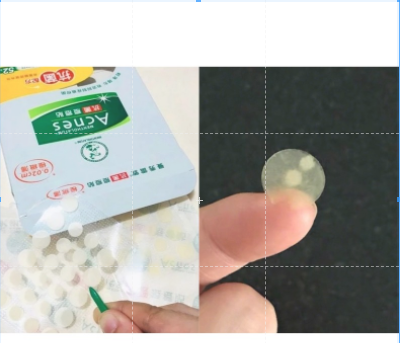 Míếng dán mụn Mentholatum Acnes từ Đài Loan