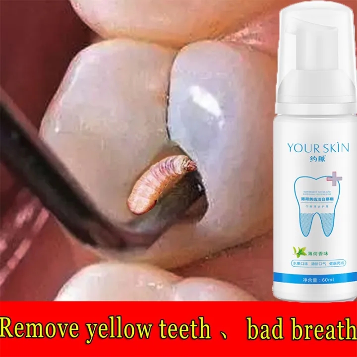 Tẩy Trắng Răng Làm Sạch Răng Miệng Khử Mùi Hôi Miệng Oral Teeth Whitening