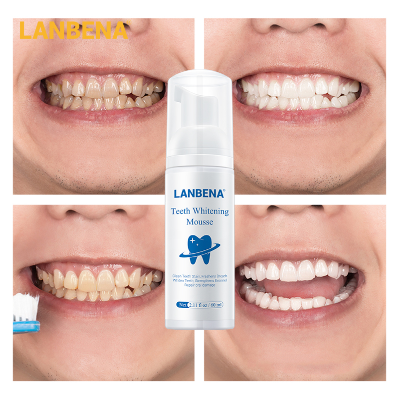 LANBENA Fresh Shining Bọt Kem đánh răng chuyên làm trắng,vệ sinh răng miệng ,loại bỏ mảng bám vết bẩn,kem đánh rặng,kem trắng răng,làm trắng,chống hôi miệng,ngăn ngừa sâu răng whitening teeth 1